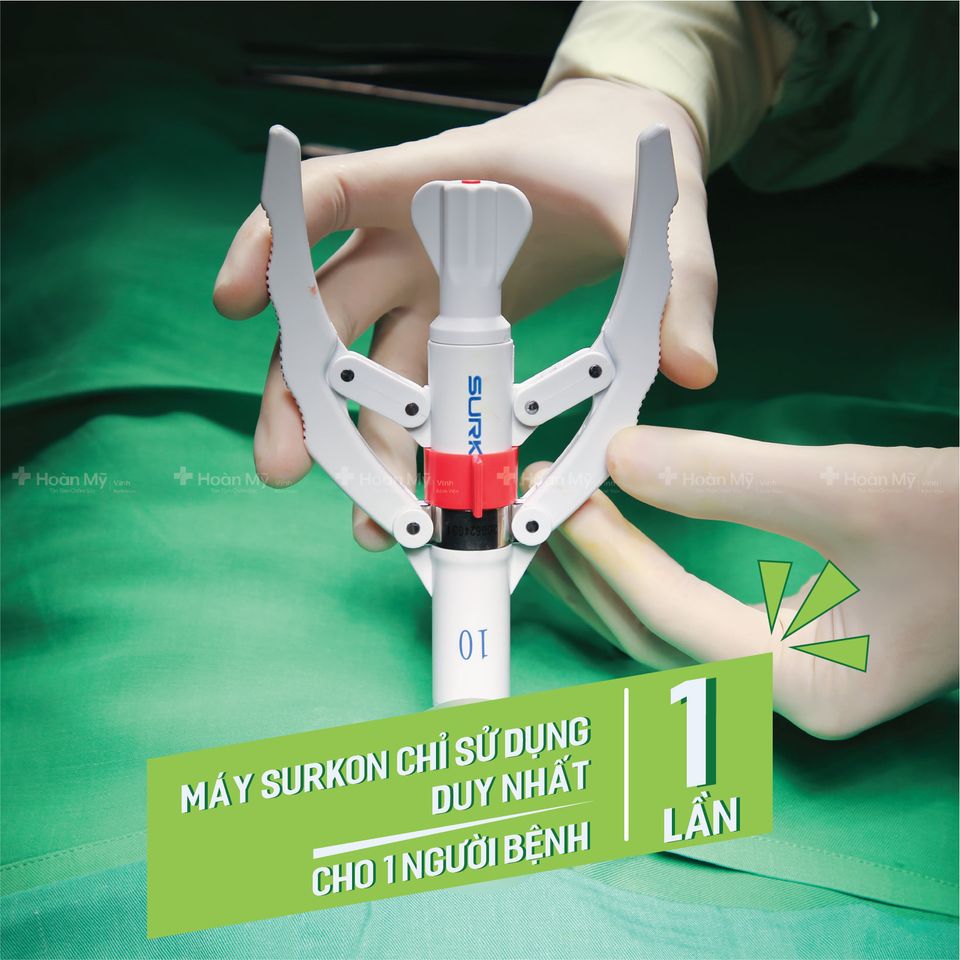 Máy cắt bao quy đầu Surkon có tốt như lời đồn? 38 may surkon 2